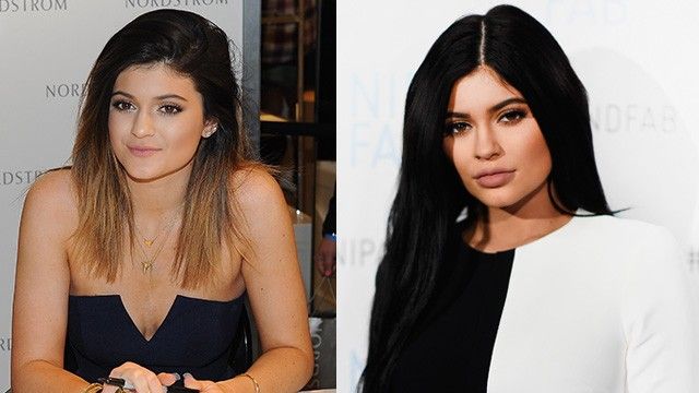 Em gái út của Kim Kardashian - Kylie gây chú ý trong giới làm đẹp năm qua nhờ đôi môi bất ngờ dày hơn trước cùng với màu son thâm, trầm bí ẩn. Sau nhiều lần bị nghi ngờ bơm môi, ngôi sao truyền hình 18 tuổi thừa nhận tiêm chất làm đầy để tăng sự tự tin. “Đó chỉ là vấn đề tự ti của bản thân tôi” - Kylie nói. Sau khi tròn 18 tuổi, Kylie khiến cư dân mạng “bỏng mắt” vì những bức ảnh tự sướng trong trang phục cắt xẻ hở bạo.