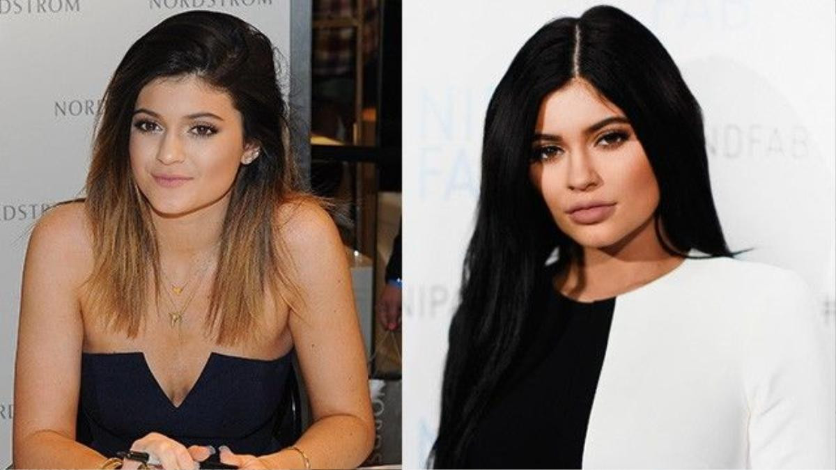 Em gái út của Kim Kardashian - Kylie gây chú ý trong giới làm đẹp năm qua nhờ đôi môi bất ngờ dày hơn trước cùng với màu son thâm, trầm bí ẩn. Sau nhiều lần bị nghi ngờ bơm môi, ngôi sao truyền hình 18 tuổi thừa nhận tiêm chất làm đầy để tăng sự tự tin. “Đó chỉ là vấn đề tự ti của bản thân tôi” - Kylie nói. Sau khi tròn 18 tuổi, Kylie khiến cư dân mạng “bỏng mắt” vì những bức ảnh tự sướng trong trang phục cắt xẻ hở bạo. 